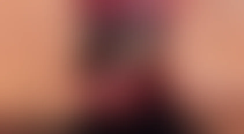 Живая мертвечина