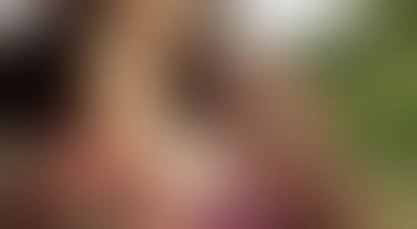 Фантомная боль