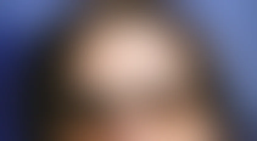 Солнечный ожог