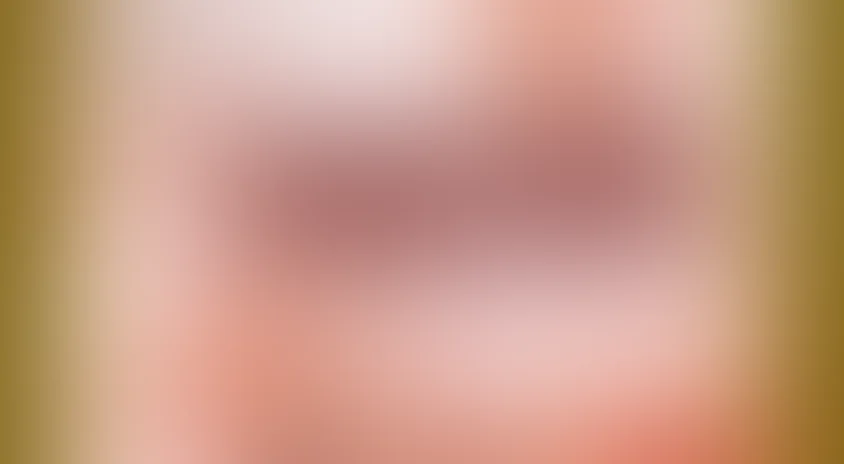 Степень риска