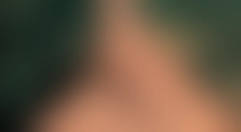 Отстреливая собак