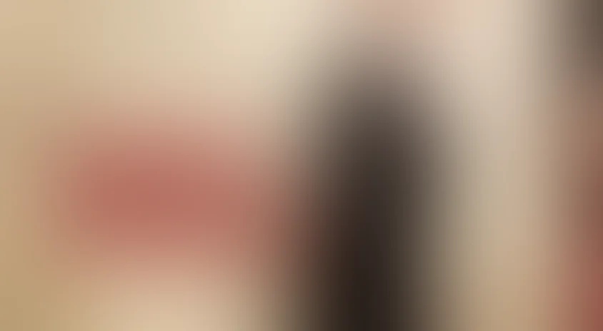 Живая мишень